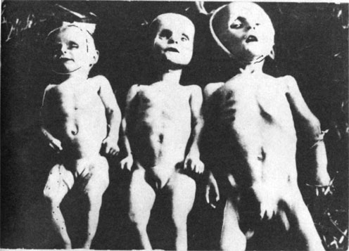 Безымянные сербские дети, отравленные инъекциями в усташском лагере для детей в Сисаке (Never again, ustashi genocide in the Independent State of Croatia (NDN) from 1941—1945)