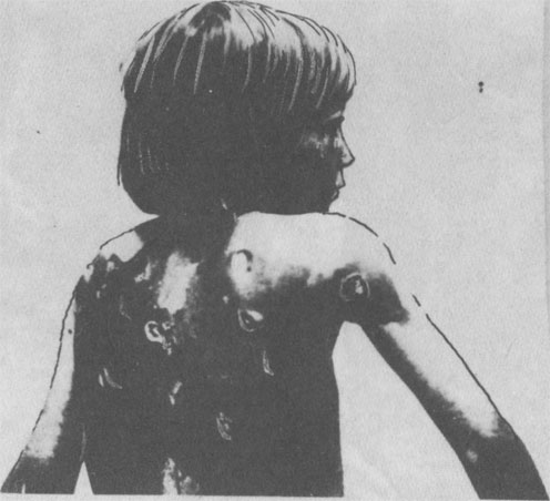Девочка лет девяти, найдена в Сербе 8 августа 1941 г. Ранена усташами ударами штыка. (Историко-дипломатический архив МИД Италии, фонд А. Е. Busta 148)
